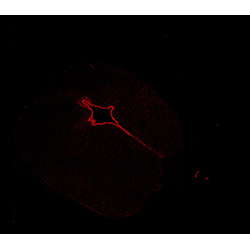 11PCW human midbrain